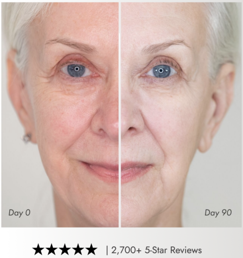 NIRA Before and After results